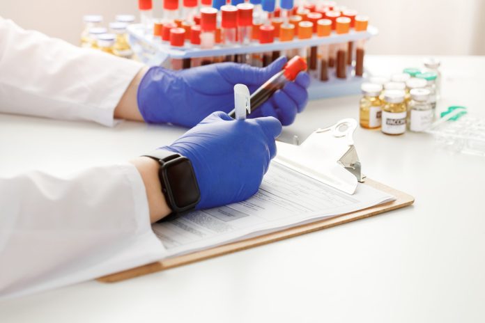 hands-of-a-doctor-holding-blood-sample-and-making-2021-09-03-17-22-00-utc-scaled